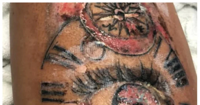  Elder, woman reached hospital after getting foot tattoo done;  Now the trouble is happening in the phase

