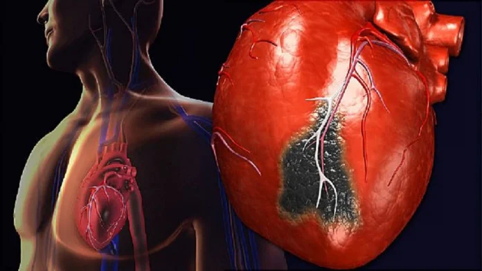 Heart Attack: Beware...! Heart attack in 'this' age group; read Heart attack : सावधान…! 'या' वयोगटातील तरुणांना हृदयविकाराचा झटका; वाचा मोठे कारण