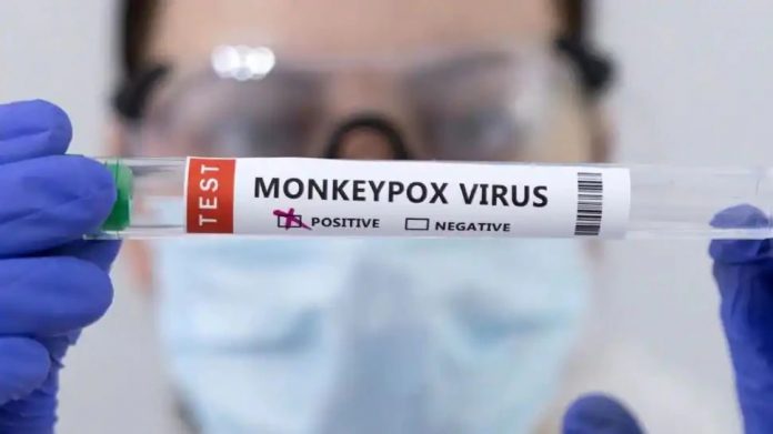 Monkeypox: After Corona, monkeypox is increasing in the country; Increase Monkeypox: देशात कोरोनानंतर वाढतोय मंकीपॉक्स; 'या' ठिकाणी रूग्णसंख्येत वाढ
