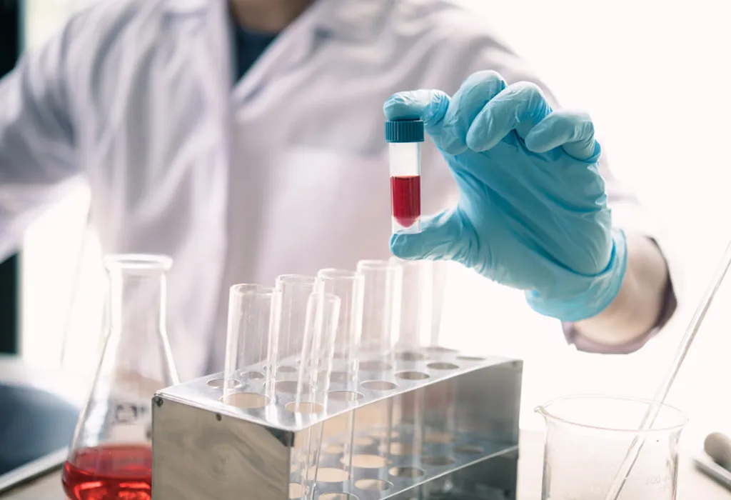 (NIPT) – What is this test and why is it done? What is NIPT?
