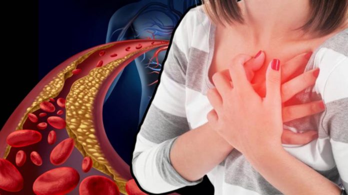Cholesterol Check: तळ हात आणि पाय देतात शरीरातील वाढत्या कोलेस्ट्रॉलबाबत अलर्ट, कसा जाणून घ्या