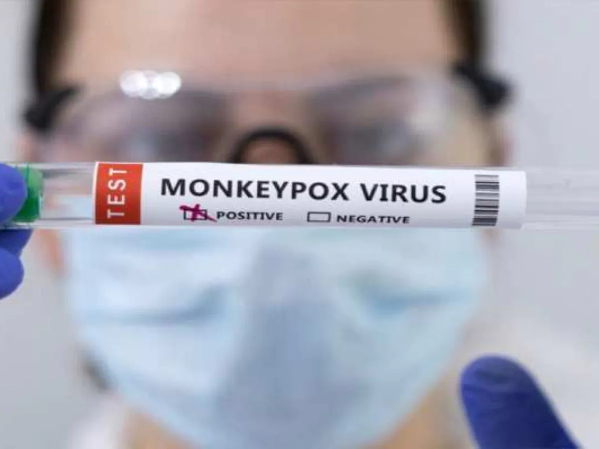 Panic spreading due to monkeypox in Brazil, poison in more Panic spreading due to monkeypox in Brazil, poison in more than 10 ports, WHO angry