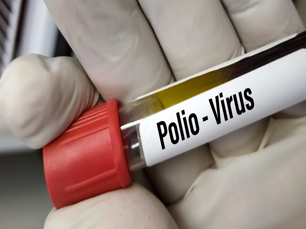 Polio virus found in the sewage of New York, officials Polio virus found in the sewage of New York, officials said - the disease spread silently