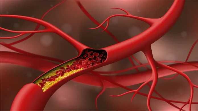 Cholesterol level things can increase cholesterol in the body, get Cholesterol ची पातळी अचानक वाढवू शकतात 'या' गोष्टी!