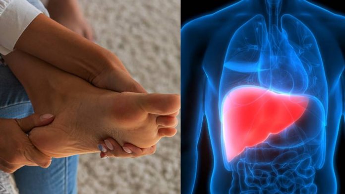 Liver Damage: तळहात आणि पायांना येतेय खाज, पैसे येणार नाहीत, लिव्हर आहे डॅमेज, डॉक्टरांना गाठा नाहीतर...
