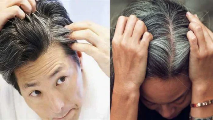 White Hair: Why Your Hair Turns White When You Are Young... So Do These Remedies